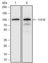 Anti-Human TOP3B Antibody [A690]