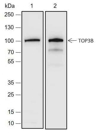 Anti-Human TOP3B Antibody [A690]