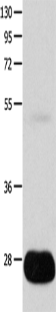 Anti-Human/Mouse POMC Antibody - ABMIUM