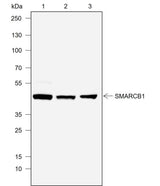 Anti-Human/Rat/Mouse SMARCB1/BAF47 Antibody [A766]