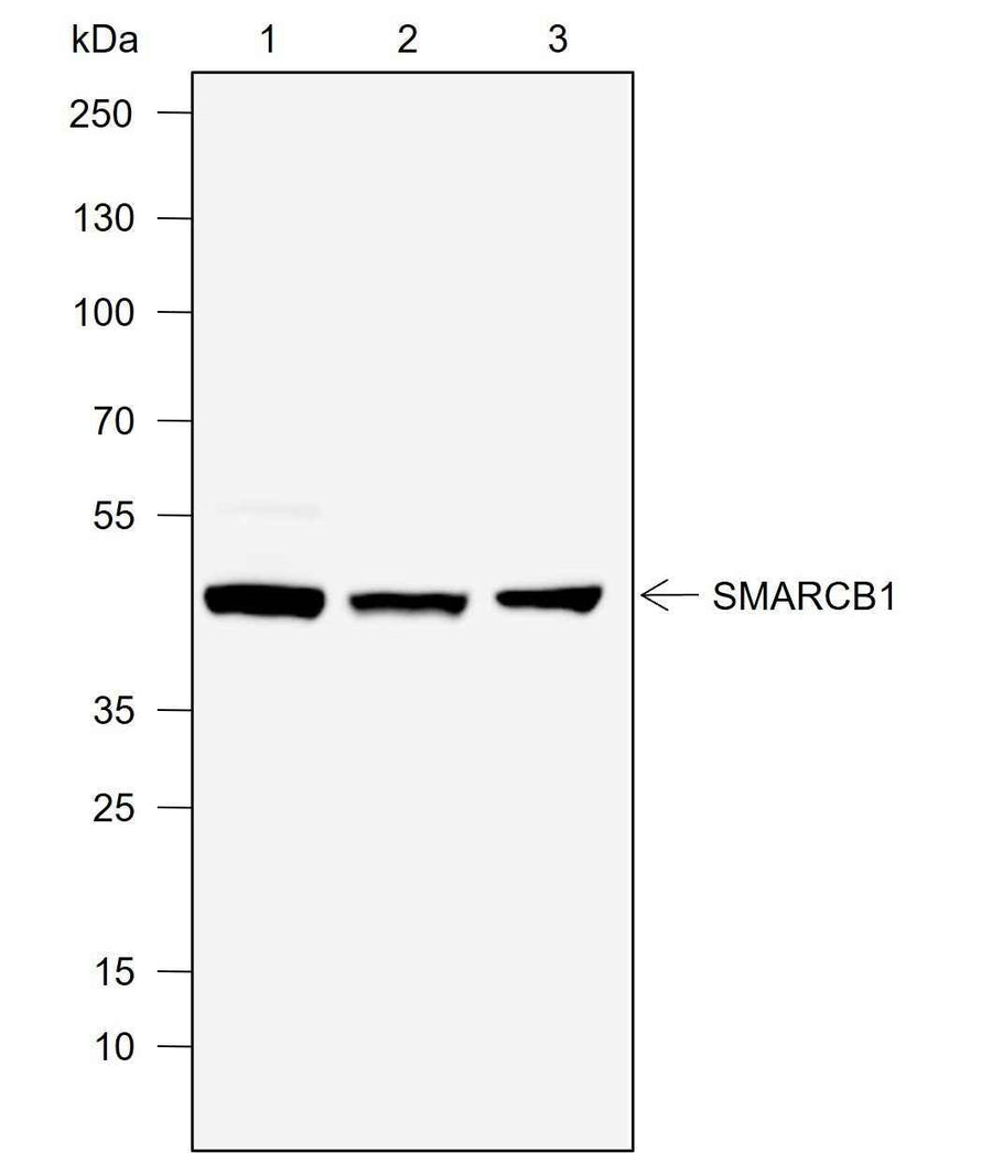 Anti-Human/Rat/Mouse SMARCB1/BAF47 Antibody [A766]
