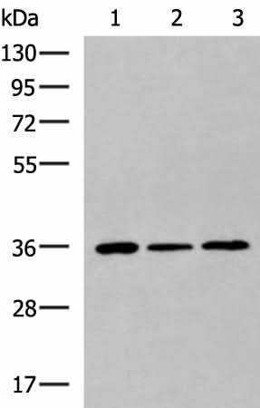 Western blot analysis of HepG2 Hela cell Mouse liver tissue lysates using KHK Polyclonal Antibody at dilution of 1:1000