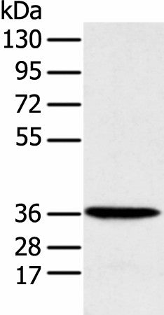 Western blot analysis of Human fetal liver tissue using MAT2B Polyclonal Antibody at dilution of 1:1000
