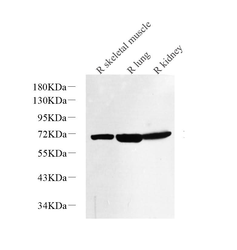 Western Blot analysis of various samples using NOX4 Polyclonal Antibody at dilution of 1:1000.