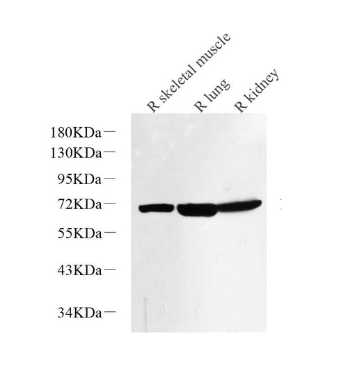 Western Blot analysis of various samples using NOX4 Polyclonal Antibody at dilution of 1:1000.