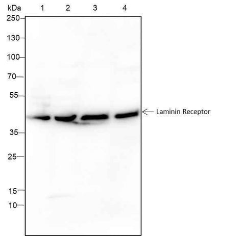 Anti-Human/Mouse Laminin Receptor Antibody [A285] - ABMIUM