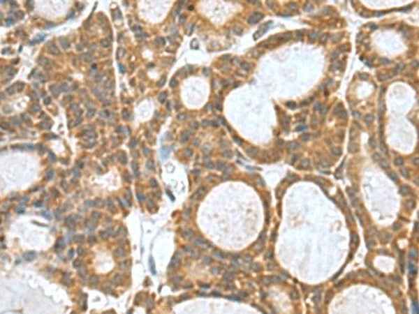 Anti-Human/Mouse KANSL1L Antibody