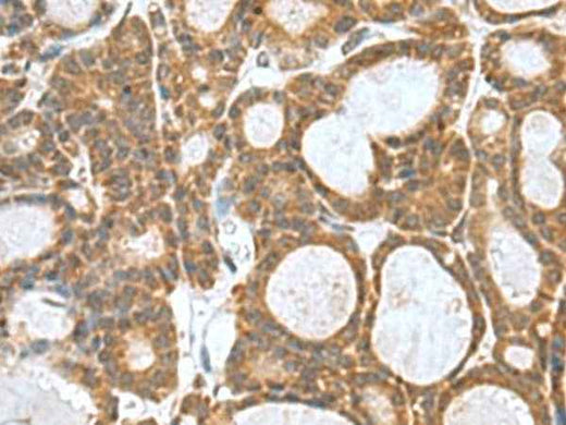 Anti-Human/Mouse KANSL1L Antibody