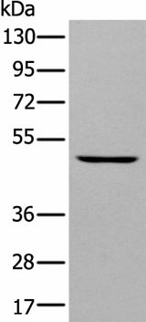 Western blot analysis of A431 cell using DAPK2 Polyclonal Antibody at dilution of 1:400