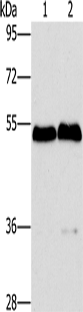 Anti-Human/Mouse SPHK2 Antibody - ABMIUM