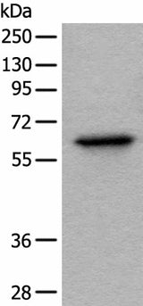 Western blot analysis of Hela cell lysate using BAIAP2L1 Polyclonal Antibody at dilution of 1:1000