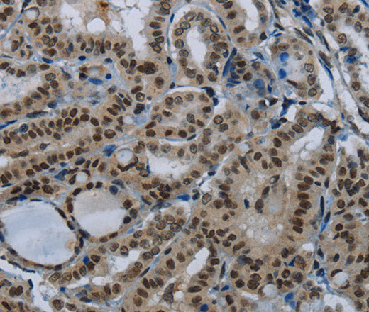 Anti-Human/Mouse/Rat NBL1 Antibody - ABMIUM