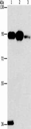 Anti-Human/Mouse PLA2G4B Antibody - ABMIUM