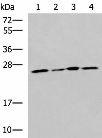Western blot analysis of LOVO Hela A549 and HT29 cell lysates using RPL13A Polyclonal Antibody at dilution of 1:1600
