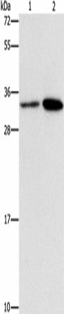 Anti-Human/Mouse CDC34 Antibody - ABMIUM
