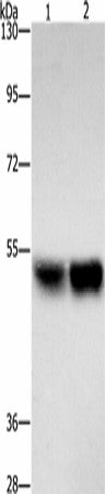 Western blot analysis of Hela cells A431 cells using ZFYVE19 Polyclonal Antibody at dilution of 1:500