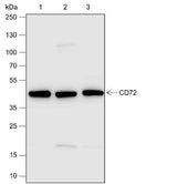 Anti-Human CD72 Antibody [A630]