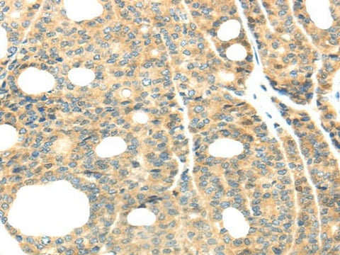 Anti-Human/Mouse TTBK2 Antibody - ABMIUM