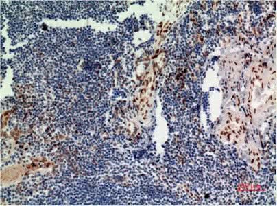 Anti-Human/Mouse/Rat ERK1 Mouse (4G11) Antibody [4G11] - ABMIUM