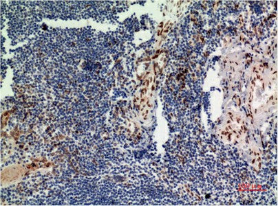 Anti-Human/Mouse/Rat ERK1 Mouse (4G11) Antibody [4G11] - ABMIUM