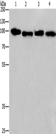 Anti-Human/Mouse/Rat CANX Antibody - ABMIUM