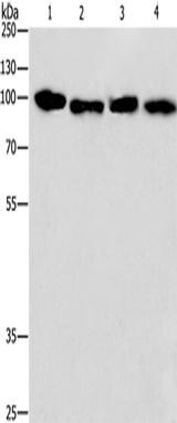 Anti-Human/Mouse/Rat CANX Antibody - ABMIUM