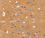 Anti-Human/Rat JAK2 Antibody - ABMIUM
