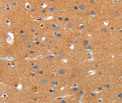 Anti-Human/Rat JAK2 Antibody