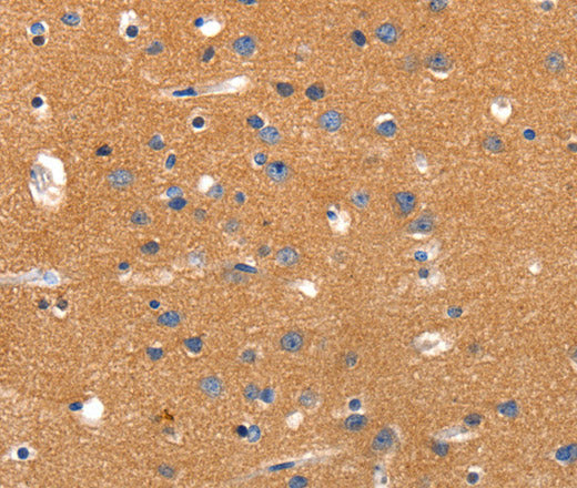 Anti-Human/Rat JAK2 Antibody - ABMIUM