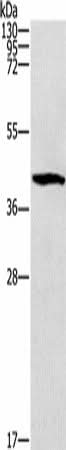 Western blot analysis of Mouse brain tissue using ZADH2 Polyclonal Antibody at dilution of 1:1000
