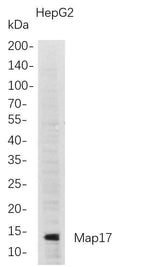 Anti-Human Map17 Antibody [B720]