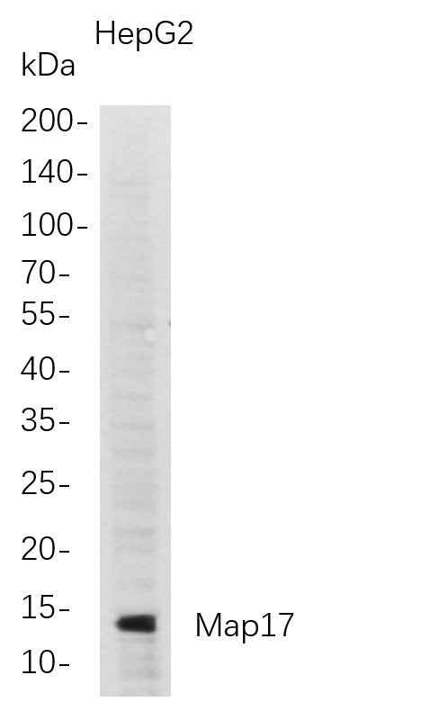 Anti-Human Map17 Antibody [B720] - ABMIUM