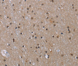 Anti-Human/Mouse MED12 Antibody - ABMIUM