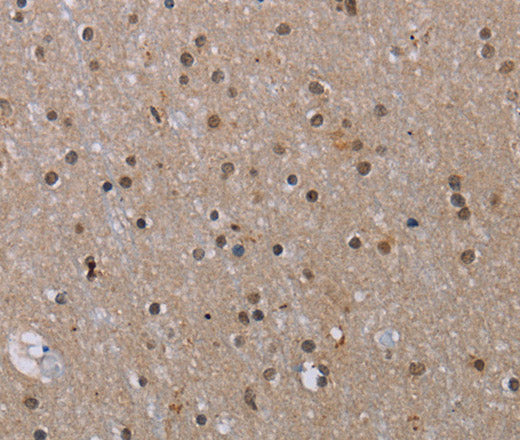 Anti-Human/Mouse MED12 Antibody - ABMIUM