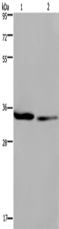 Anti-Human EMD Antibody - ABMIUM
