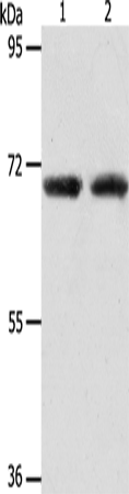 Anti-Human/Mouse ACOT11 Antibody - ABMIUM