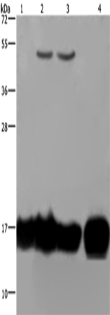 Anti-Human IL17C Antibody - ABMIUM