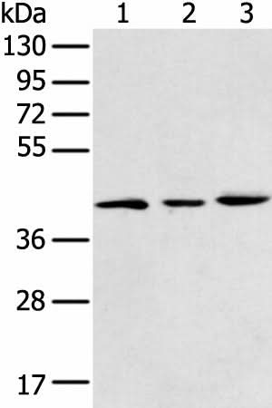 Western blot analysis of 293T K562 and Raji cell using DCX Polyclonal Antibody at dilution of 1:400